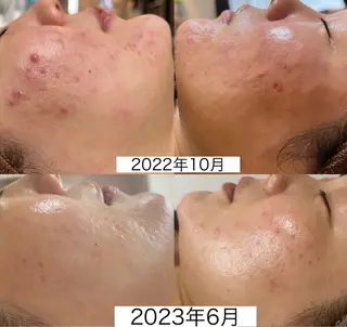 NiU.BEAUTY🥥池袋店所属・ハーブピーリング専門 NiU.BEAUTYのエステ・リラクイメージ