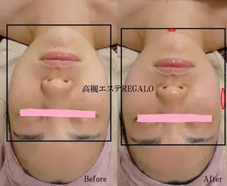 REGALO所属・矢野 さやかのエステ・リラクイメージ