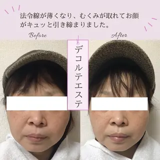 小顔エステサロン マインドール所属・泉大津エステ毛穴   シミ専門サロンのエステ・リラクイメージ