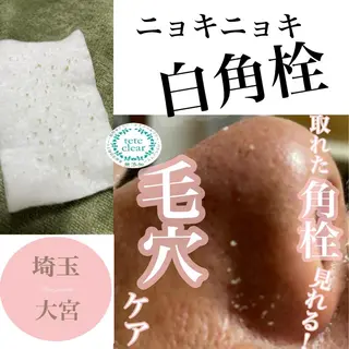 private salon  Dea_maris シュガーリング＆パーソナルボディケア所属・シミ改善・韓国肌管理 ボディメイク痩身のその他イメージ