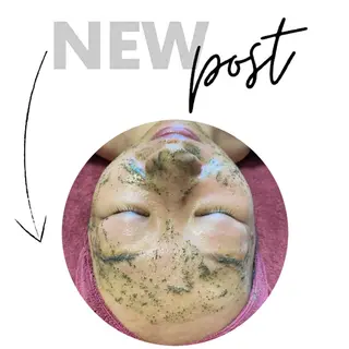 Chalon所属・REVI取扱・肌悩み 毛穴Chalonのエステ・リラクイメージ