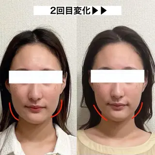 顔の歪み矯正専門 宮内翔のエステ・リラクイメージ