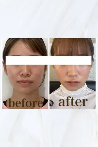 小顔と ヘッドスパのお店のエステ・リラクイメージ