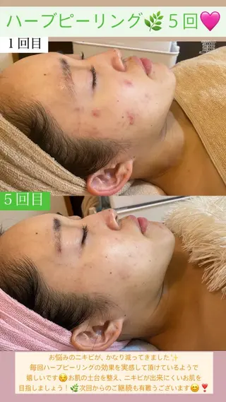 Salon de Lino 御器所のエステ・リラクイメージ