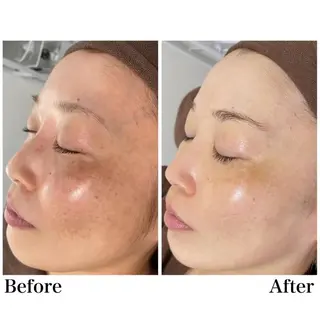 Rapport ラポールのエステ・リラクイメージ