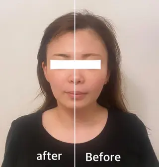 ✨美肌水光✨ アトリエリュバンのエステ・リラクイメージ