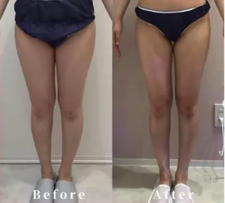 beautysalon SAKUセンター南所属・ビューティーサロン SAKU センター南のエステ・リラクイメージ