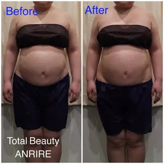 ANRIRE (アンリール)のエステ・リラクイメージ