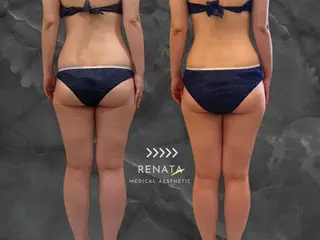 RENATA🕊 脂肪冷却専門店六本木のエステ・リラクイメージ