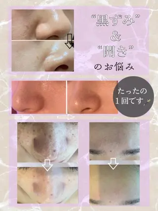 Beauty Maxのエステ・リラクイメージ