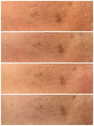 ☆痩身/小顔☆ 結果出します☆のエステ・リラクイメージ