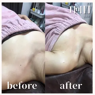 温活beautyサロンNeroli所属・切らない脂肪吸引🔥 Neroliまりこのエステ・リラクイメージ