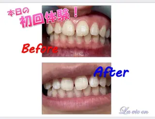 セルフホワイトニングサロン　ラヴィアン所属・ホワイトニングサロン La vie enのその他イメージ