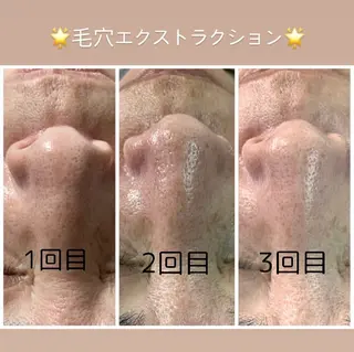 Purnama(ﾌﾟﾙﾅﾓ)所属・Purnama あきのネイルデザイン