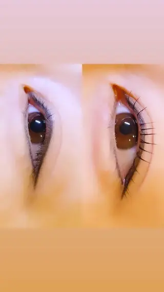 マツエク・マツパ ロニセラ アイラッシュのマツエク・マツパデザイン