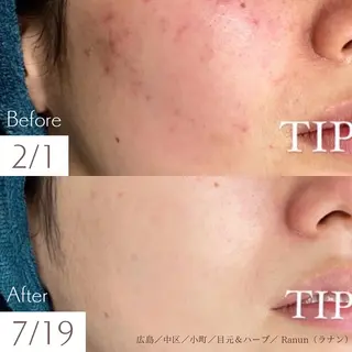 Mau beauty salon所属・Mau (マウ)のエステ・リラクイメージ