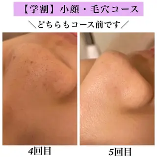 Bellesthe (ベルエステ)のエステ・リラクイメージ