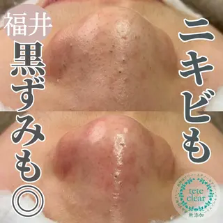 毛穴ケア専門サロン Yourmeユアミーのエステ・リラクイメージ