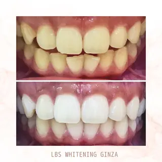 メンズ LBSホワイトニング 銀座店💎店長浦和のその他イメージ