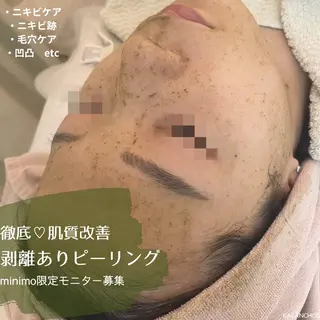 肌質改善 KALANCHOEのエステ・リラクイメージ