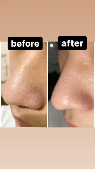 脱毛・エステサロン LuLuNのエステ・リラクイメージ