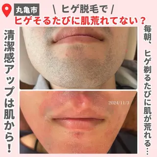 前山 くるみのエステ・リラクイメージ