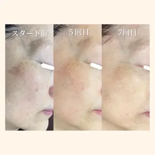 マツエク・マツパ 韓国肌管理 【毛穴専科】のエステ・リラクイメージ