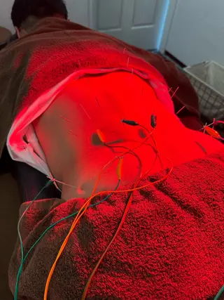 美容鍼灸整体サロンBeauJu所属・小顔矯/美容鍼/鍼灸 BeauJuのその他イメージ