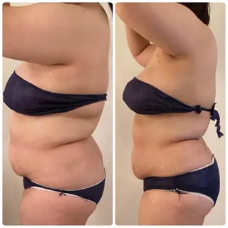 FLEUR大阪・整体 ・ハイフ・痩身・小顔のエステ・リラクイメージ