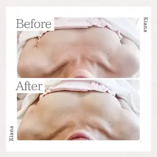 【バスト専門店 】 Kiana のエステ・リラクイメージ