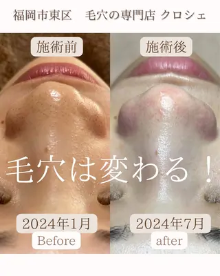 政時 鈴奈のエステ・リラクイメージ