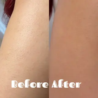 高槻駅近/脱毛サロン【Salon Repo】所属・加代 結愛のエステ・リラクイメージ