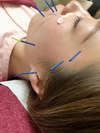 美容鍼灸女性専用 りんご鍼灸治療院のその他イメージ