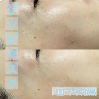 Lilyboo 池袋のエステ・リラクイメージ