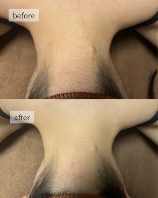 HINANO矢場町店【ヒナノ】所属・脱毛/肌改善🌿 HINANO 村田のエステ・リラクイメージ