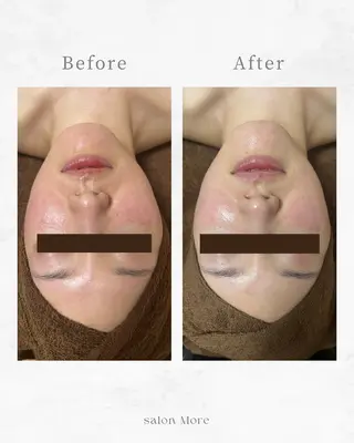 salon More所属・出口 玲菜のエステ・リラクイメージ