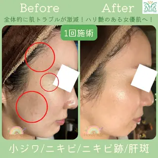 剥離するハーブ🌈 Honey Sideのエステ・リラクイメージ