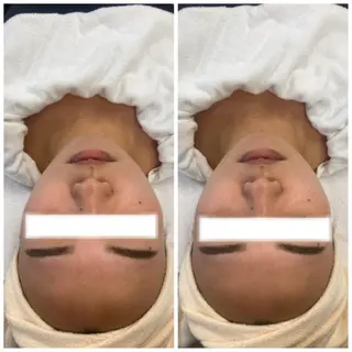 ネイル マツエク・マツパ アイブロウ 肌質改善美容サロン ému 用賀のエステ・リラクイメージ