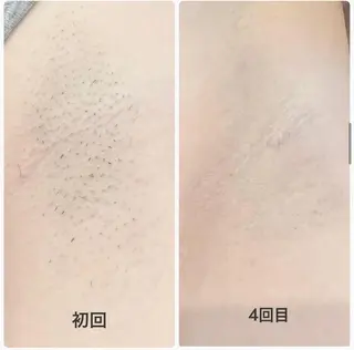 脱毛まつげサロン JESSICA荻窪店の眉毛・アイブロウイメージ