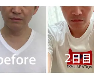 小顔と ヘッドスパのお店のエステ・リラクイメージ