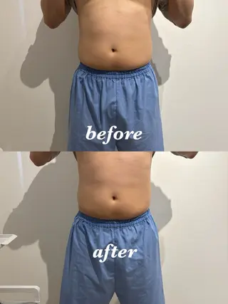 メンズ 腸活サポート みなみののエステ・リラクイメージ