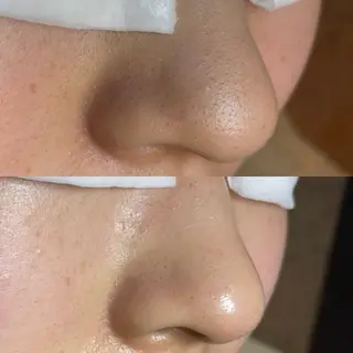 Re:Belle所属・Re:Belle 久留米 : 中島のエステ・リラクイメージ