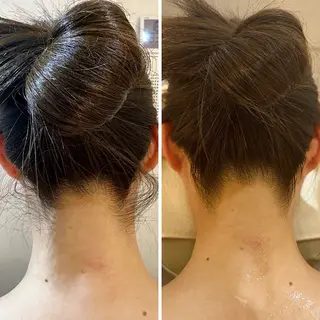 うなじ脱毛/美肌脱毛 LABELのエステ・リラクイメージ