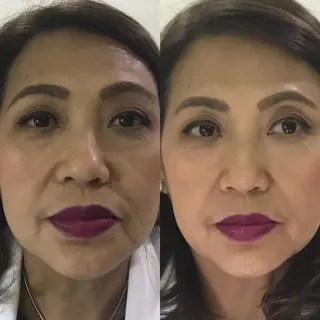 【福岡市西区 エステ】 GRANVIR(グランヴィール)所属・GRANVIR グランヴィールのエステ・リラクイメージ