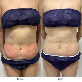 冷却専門店 SLARIのエステ・リラクイメージ