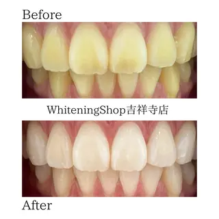 ホワイトニング ショップ吉祥寺店のエステ・リラクイメージ