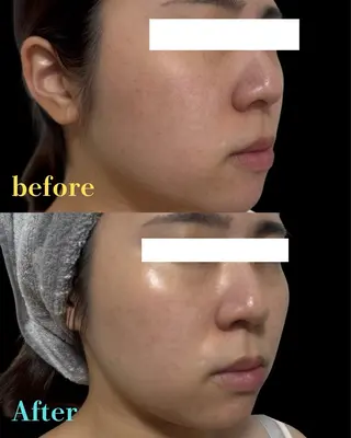 Noel所属・サロン Noelのエステ・リラクイメージ