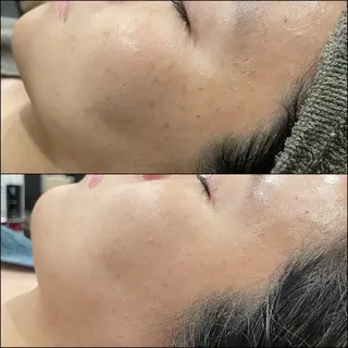 LiZA エステティックサロンのエステ・リラクイメージ