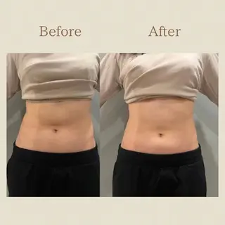 お腹痩せエステ Flat BELLY 恵比寿所属・【腸もみ/脂肪冷却】 お腹エステ/恵比寿のエステ・リラクイメージ