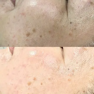 &me ayakaのエステ・リラクイメージ